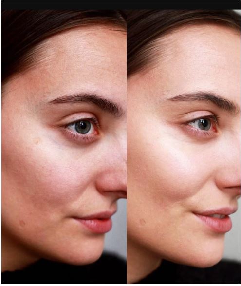 10 Glowing Face Yoga Moves to Boost Circulation
